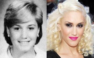 Look How Gwen Stefani’s Plastic Surgery Has Helped Her Shift From ...