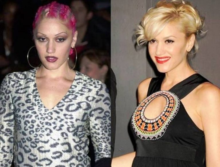 Look How Gwen Stefani’s Plastic Surgery has Helped Her Shift from ...